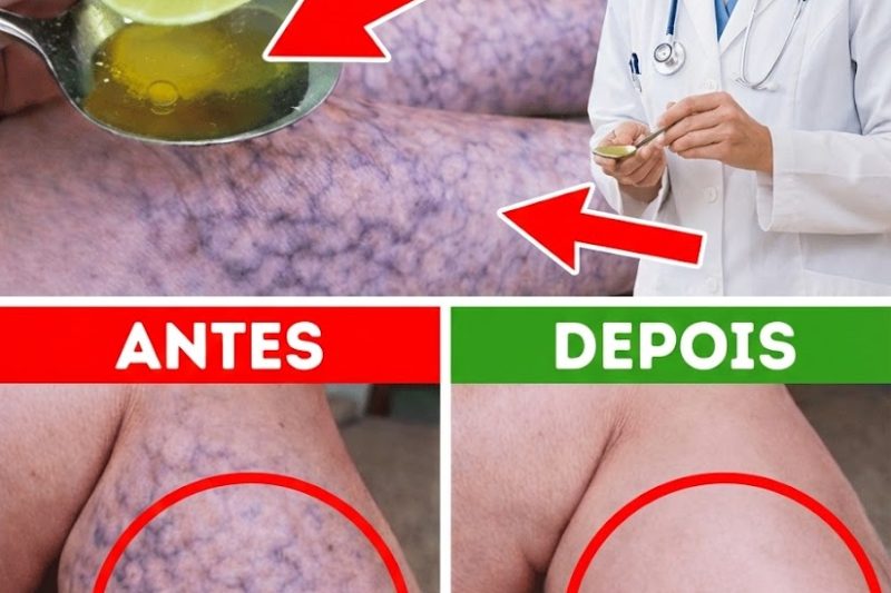 10 Maneiras Naturais de Apoiar uma Circulação Saudável e Aliviar os Sintomas das Varizes