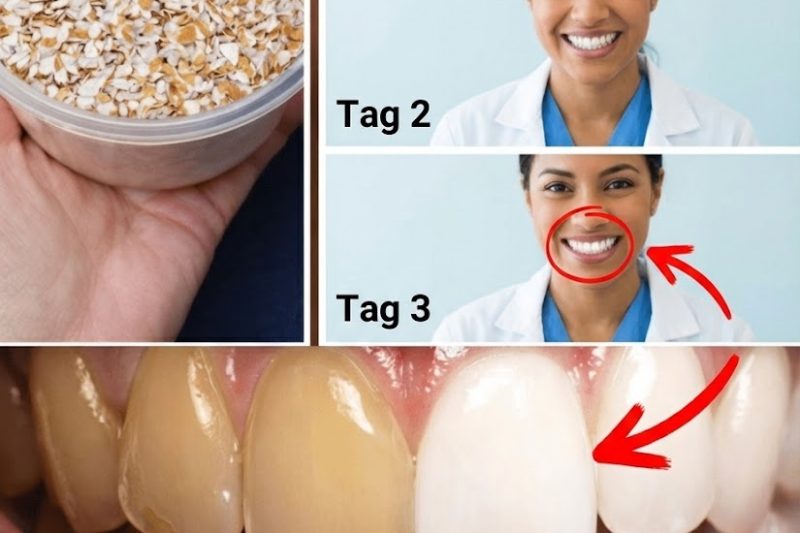 Eierschalen zur Zahnaufhellung: Ein natürlicher Weg zu einem strahlenderen Lächeln