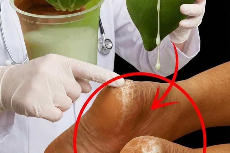 🍃 O Látex Leitoso da Mamão-Verde que Cura Verrugas, Calcanhares Rachados e Rejuvenesce a Pele – 18 Usos Transformadores