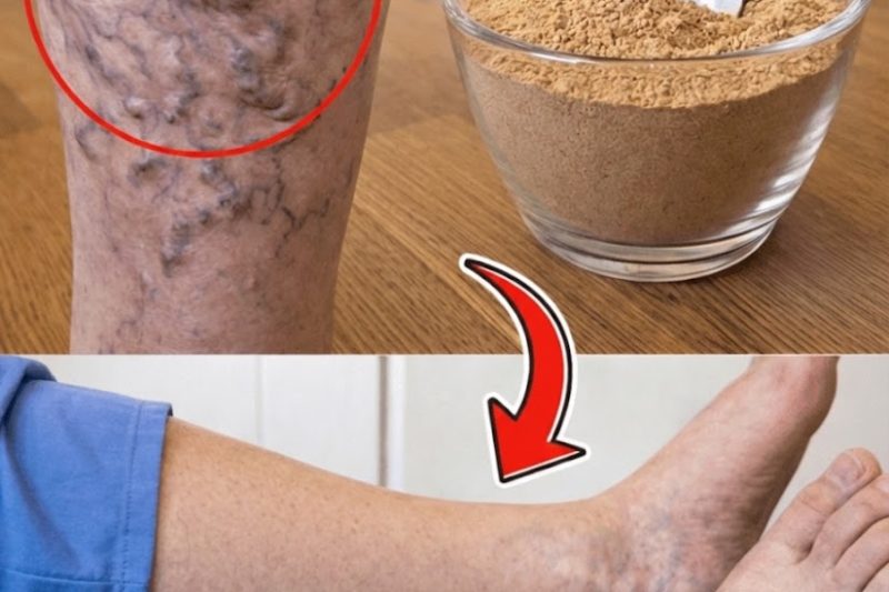 10 Maneiras Naturais de Apoiar a Circulação Saudável e Aliviar o Desconforto das Varizes