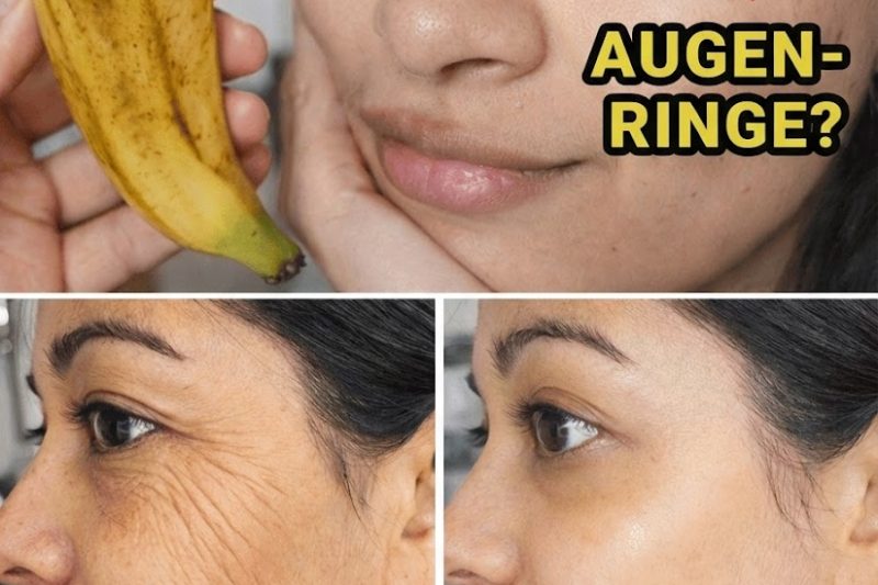 Natürlich schön ab 40: Die erstaunlichen Hautvorteile von Bananenschalen