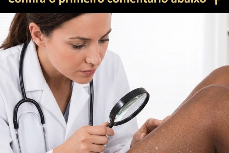Por que Surgem Manchas Brancas na Sua Pele? Causas Ocultas que Você Não Deve Ignorar