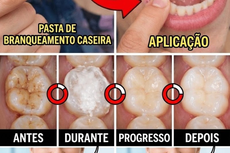 5 Remédios Naturais para Cáries que Idosos Frequentemente Ignoram — e os Benefícios Ocultos por Trás Deles