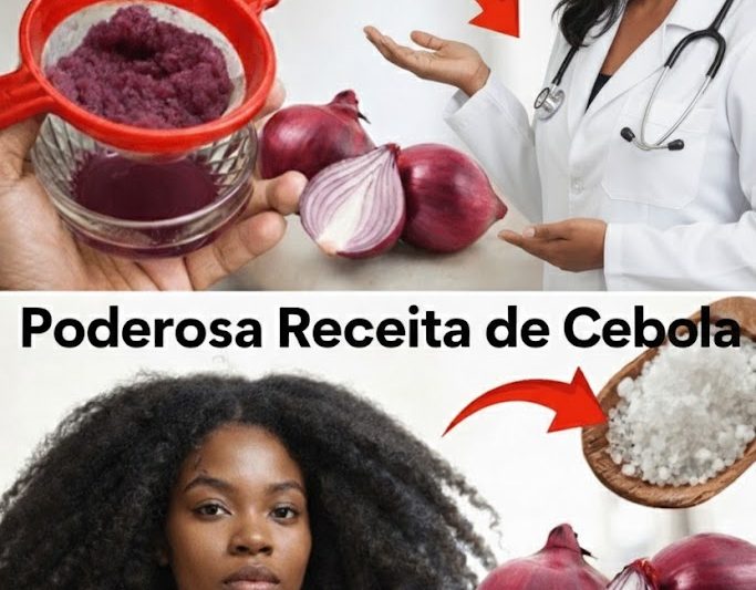 Suco de Cebola para o Crescimento do Cabelo: O Que Apenas 7 Dias Podem Fazer Pelo Seu Couro Cabeludo