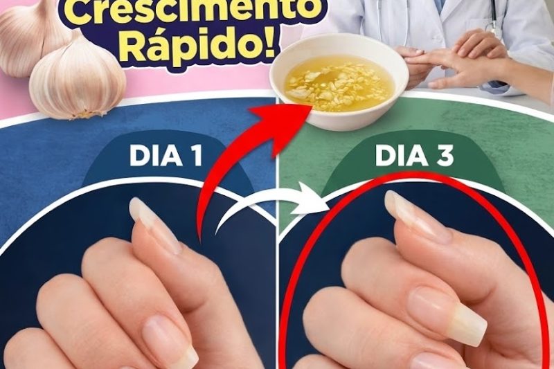 O Alho Pode Realmente Ajudar a Fortalecer e Embelezar as Unhas? A Surpreendente Dica Natural que Milhares Estão Testando