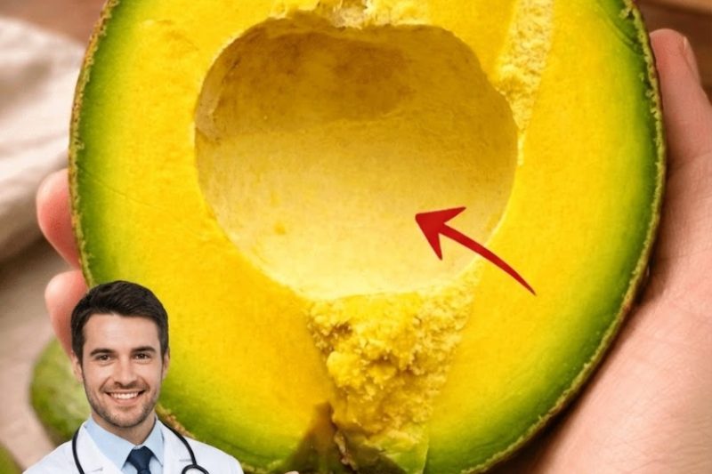 Médico Revela: Comer Abacates Pode Causar Efeitos Surpreendentes Que Você Deve Conhecer