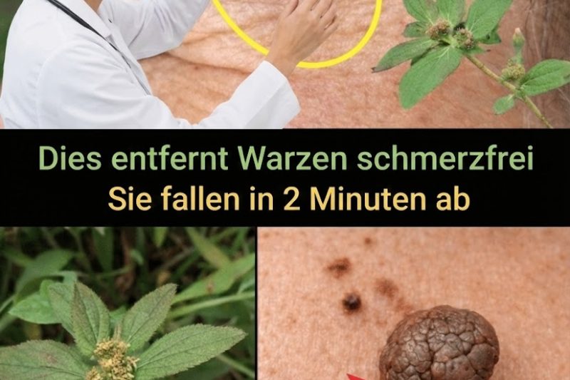 7 Natürliche Ansätze zur Unterstützung bei Warzen und für ein besseres Hautgefühl