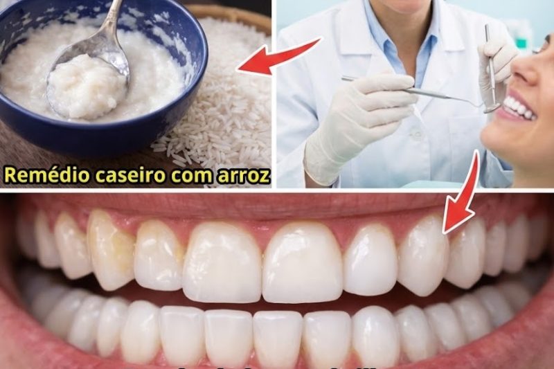 Como Clarear o Sorriso Naturalmente e Reduzir o Tártaro em Casa: 12 Remédios Suaves Comprovados pela Tradição e Ciência