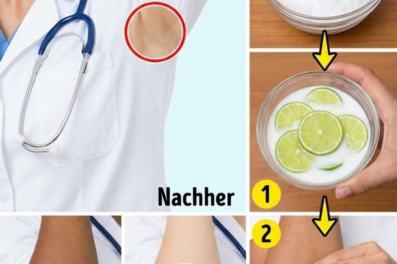 Sanft dunkle Ellbogen, Knie und Achseln mit Zitrone aufhellen – so geht’s richtig