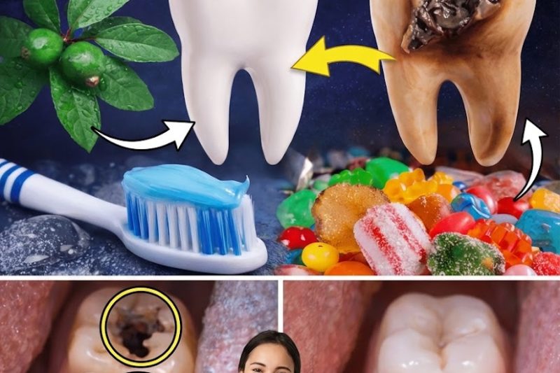 Top 3 Maneiras Simples de Usar Folhas de Goiaba para Alívio da Cárie Dentária – Opções Naturais e Acessíveis