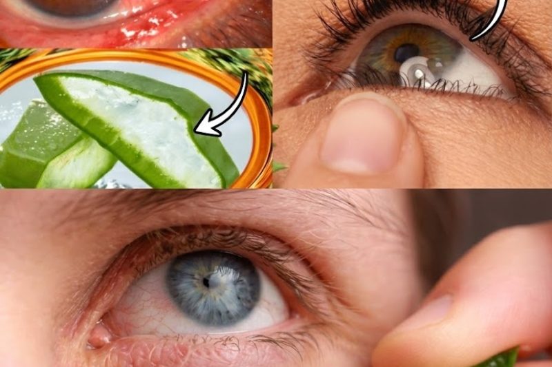 Pode a Aloe Vera Oferecer Suporte Natural para Olhos Vermelhos, Secos e Irritados?