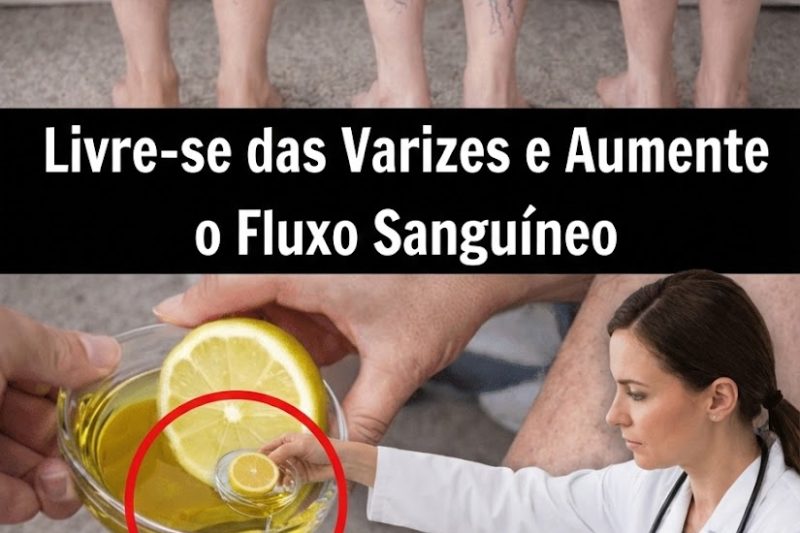 10 Maneiras Naturais de Apoiar Veias mais Saudáveis e Melhorar a Circulação para Varizes