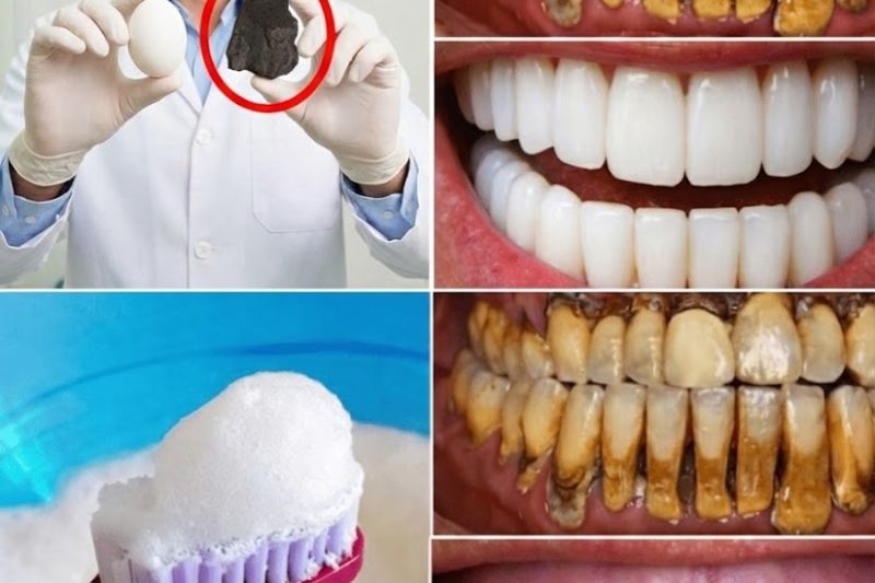 Descubra o Segredo da Cozinha para Apoiar um Sorriso Naturalmente Mais Brilhante: O Potencial do Cálcio da Casca de Ovo