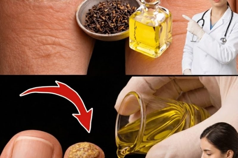 O Truque Natural Simples que Está Ajudando Milhares com Mais de 50 a Recuperar Unhas Saudáveis e Sem Fungos