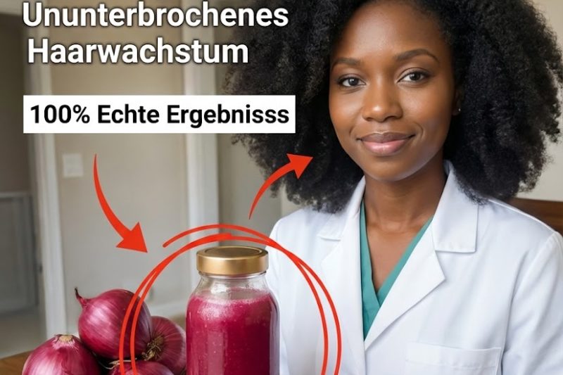 Das einzige natürliche Hausmittel, das in nur wenigen Wochen sichtbare Haarverbesserungen zeigen kann: Zwiebelsaft für Haarwachstum