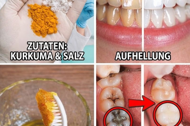 Kurkuma zur Zahnaufhellung: Funktioniert dieses natürliche Mittel wirklich?