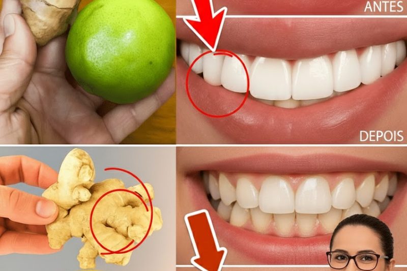 Desbloqueie o Segredo para Dentes Brancos e Radiantes em Apenas 2 Minutos – Sem Precisar de Dentista! ✨