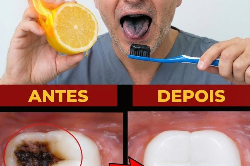 Carvão Ativado e Limão Podem Realmente Ajudar os Dentes? A Verdade Por Trás da Tendência