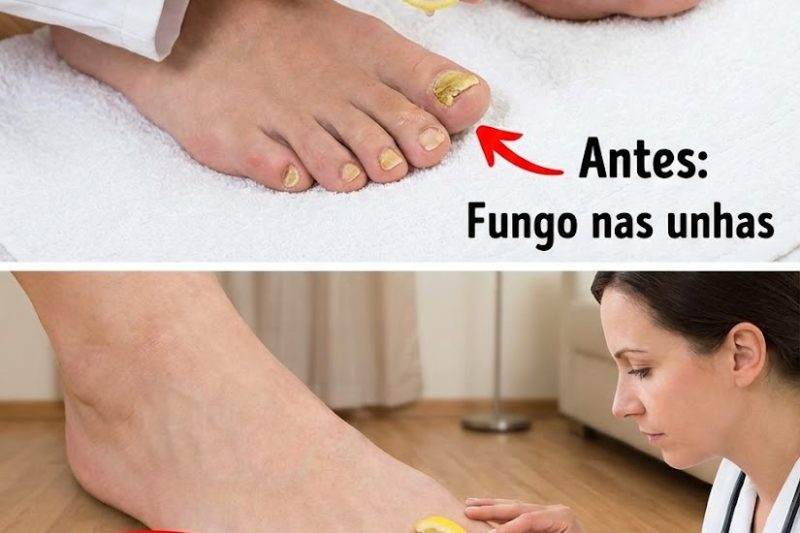Descubra o Truque do Limão: Pés Naturalmente Frescos e Pele Mais Macia
