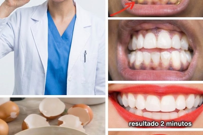 Clareamento Dental com Ovo e Café: O Remédio Caseiro Viral Que Pode Ajudar a Iluminar Dentes Amarelados – O Que Funciona de Verdade e O Que Exige Cuidado