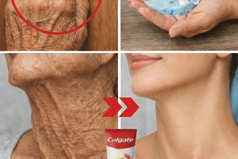 “As Pessoas Pensaram Que Eu Tinha Feito Procedimentos Estéticos” – Uma Forma Natural e Suave de Atenuar Rugas e Manchas Escuras nas Mãos e Braços (Receita Simples Incluída)