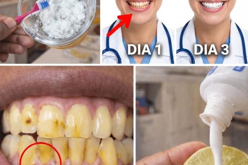 Clareie Seu Sorriso em Casa: Truques Seguros e Rápidos de Clareamento Dental Que Realmente Ajudam