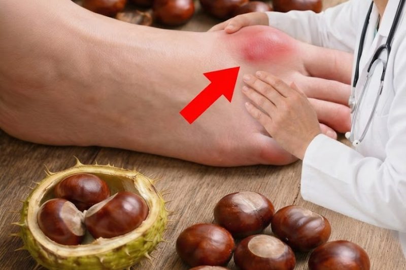 Castanhas: O Superalimento da Estação Que Pode Ajudar a Aliviar Pés e Tornozelos Inchados Naturalmente