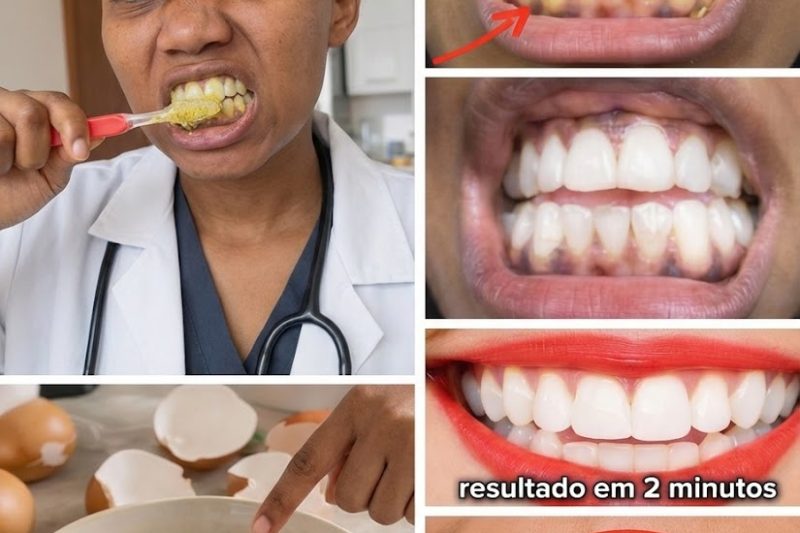 Clareamento Dental com Ovo e Café: O Remédio Caseiro Viral que Pode Iluminar Sorrisos Amarelados – O Que Funciona de Verdade e o Que Exige Cuidado