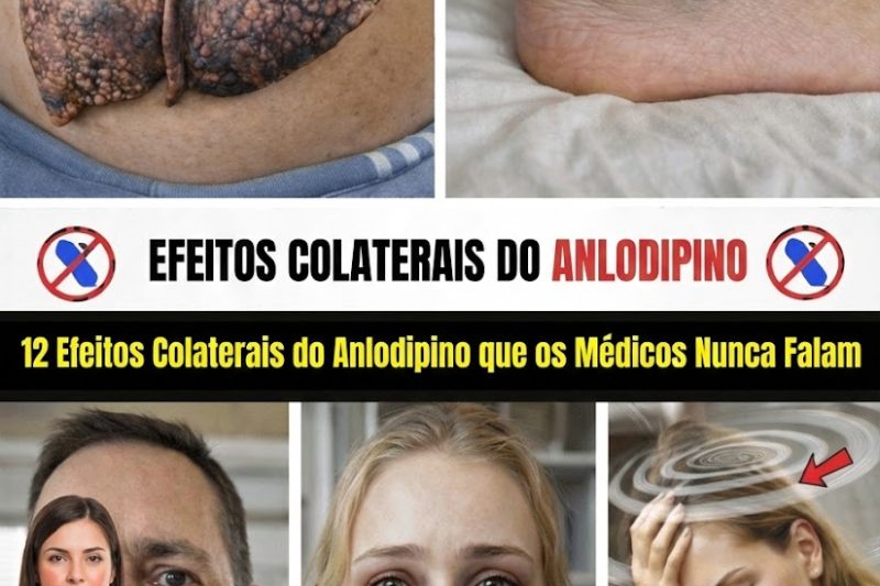12 Efeitos Colaterais Pouco Conhecidos da Amlodipina Que Você Precisa Conhecer Agora