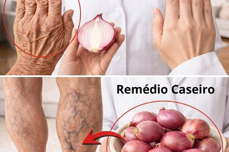 O Segredo Japonês para Suavizar Rugas: Um Creme Caseiro Simples de Cebola