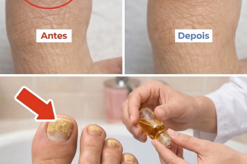 O Ritual Noturno Simples Que Está Ajudando Milhares de Pessoas a Recuperar Unhas Claras e Saudáveis