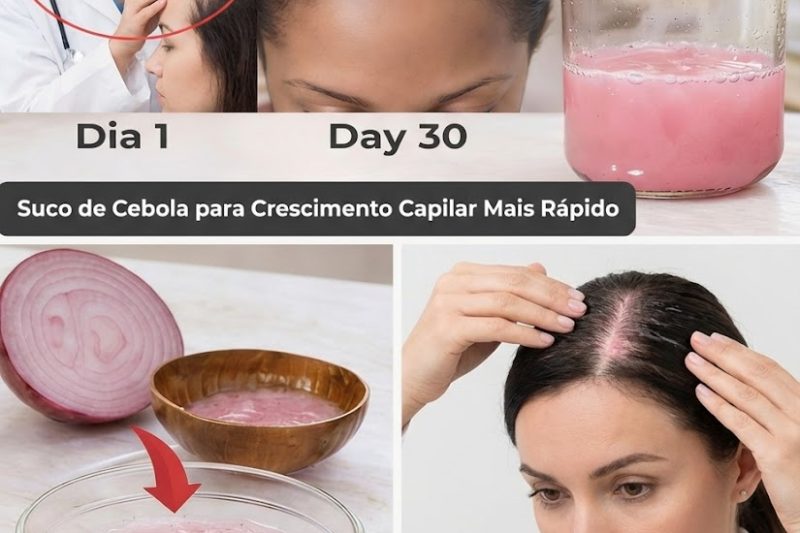 Suco de Cebola para o Crescimento Capilar: O Que Apenas 7 Dias Podem Fazer pelo Seu Couro Cabeludo