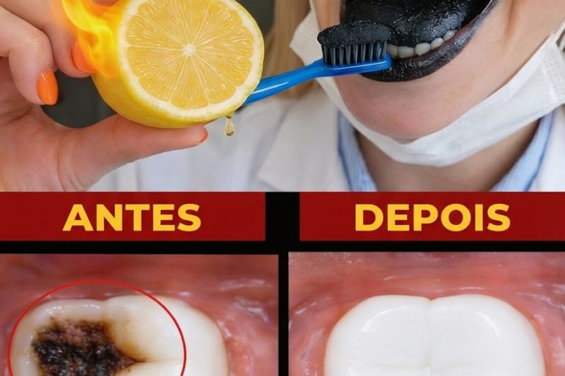 Carvão Ativado e Limão Realmente Ajudam os Dentes? A Verdade por Trás Dessa Tendência