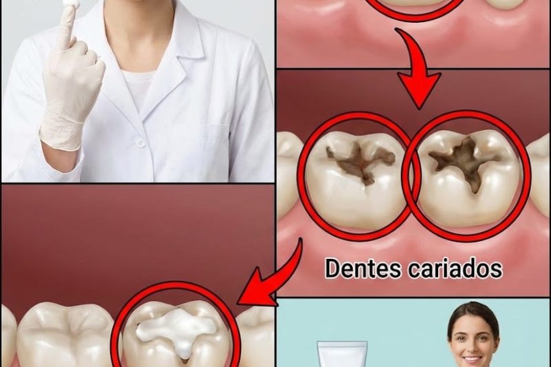 Dicas Naturais Simples para Manter os Dentes Saudáveis: 5 Remédios Caseiros Poderosos que Podem Ajudar a Prevenir Cáries