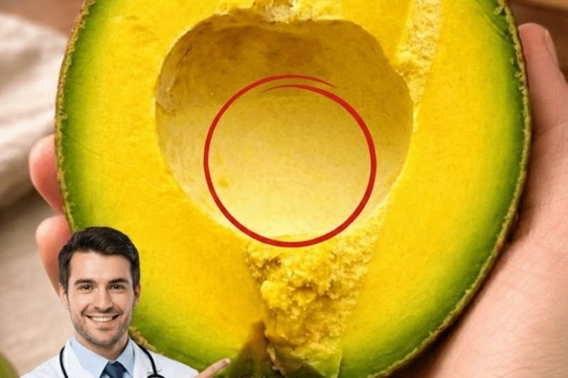 Médicos Alertam: Comer Abacate Pode Causar Efeitos Inesperados Que Você Precisa Conhecer