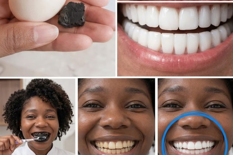 Uma Rotina Simples de 3 Minutos para Clarear os Dentes Naturalmente em Casa
