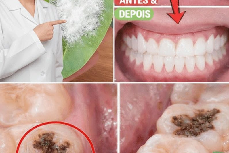 Guava Leaves for Stronger Teeth: The Simple Daily Ritual That May Surprise You