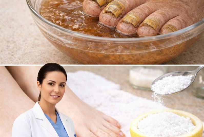 Limão nos Pés: Uma Alternativa Natural que Muitas Pessoas Estão Testando Contra Fungos