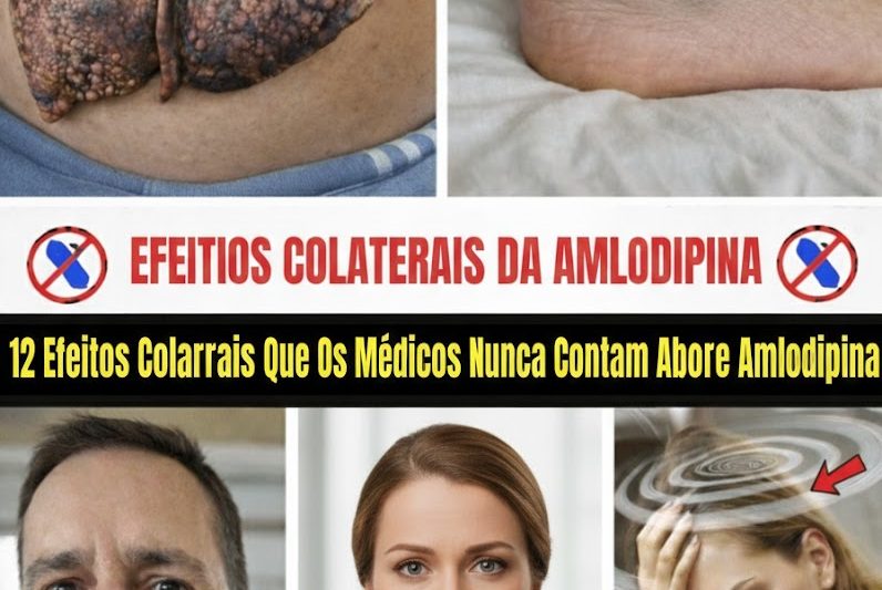 12 Efeitos Colaterais Pouco Conhecidos da Amlodipina Que Você Precisa Conhecer Agora