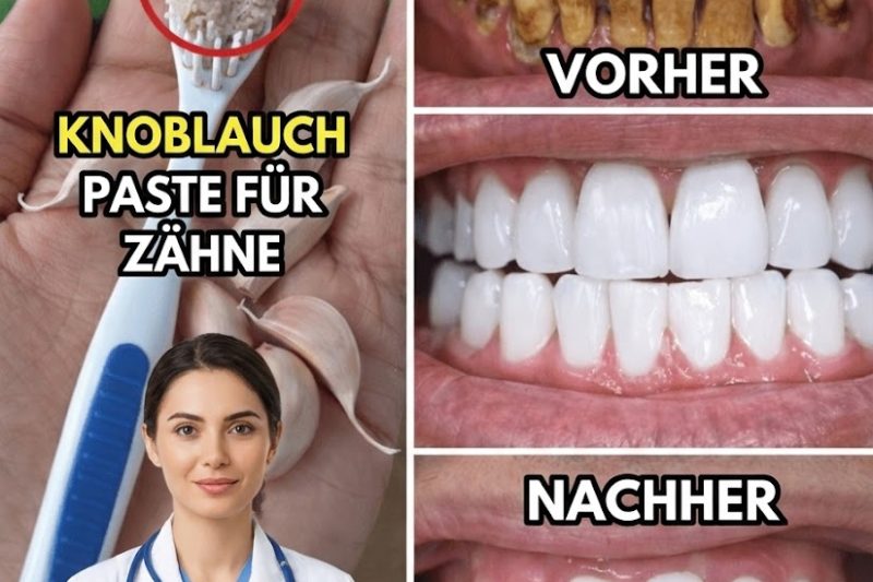 Der schnellste Weg zu einem strahlenderen Lächeln zu Hause: Eine einfache 3-Minuten-Paste aus Natron und Wasserstoffperoxid