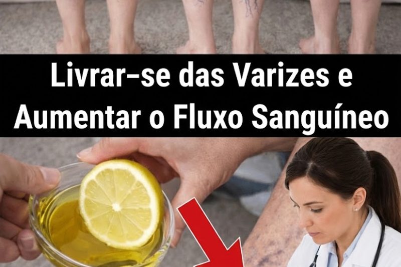 10 Maneiras Naturais de Apoiar Veias Mais Saudáveis e Melhorar a Circulação nas Varizes