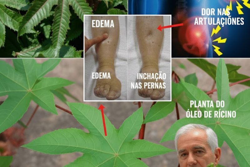 A Folha Proibida que Tentaram Esconder: 10 Segredos da Folha de Mamona para Aliviar Dores, Fortalecer o Cabelo e Desintoxicar Naturalmente