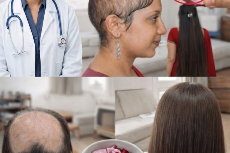 Água Milagrosa de Cebola: Este Simples Remédio da Cozinha Pode Ajudar a Recuperar Cabelos Ralos Naturalmente?