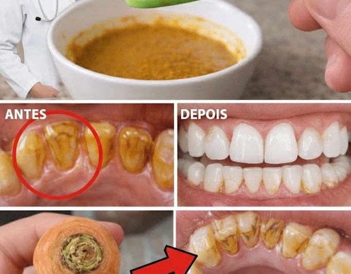 Clareamento Dental Caseiro com Bicarbonato de Sódio: Uma Opção Natural e Suave para um Sorriso Mais Brilhante