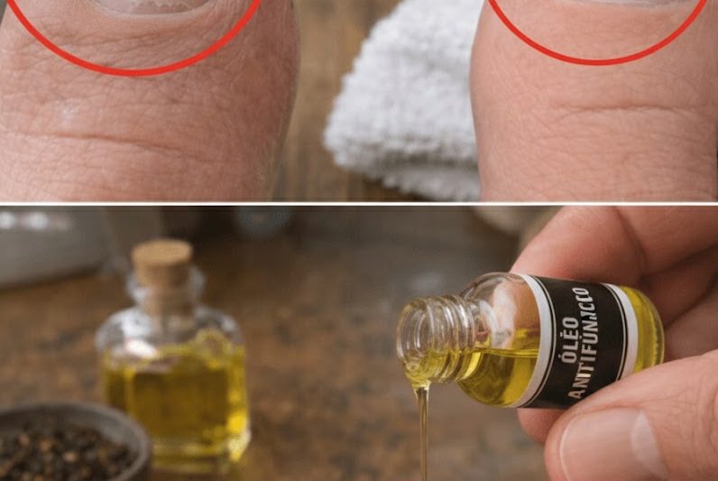 Descubra a Combinação Simples da Despensa que Muitas Pessoas Estão Testando para Melhorar a Aparência da Micose nas Unhas dos Pés