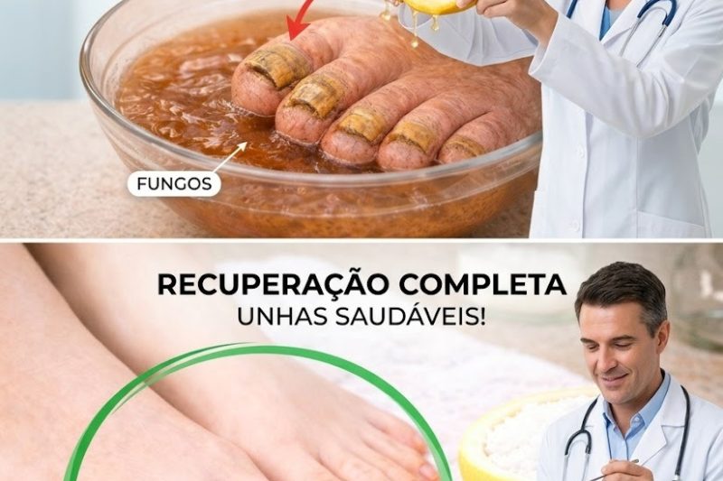 Explorando o Limão como Opção Natural para o Cuidado dos Pés: O Que as Pessoas Estão Tentando Contra Fungos