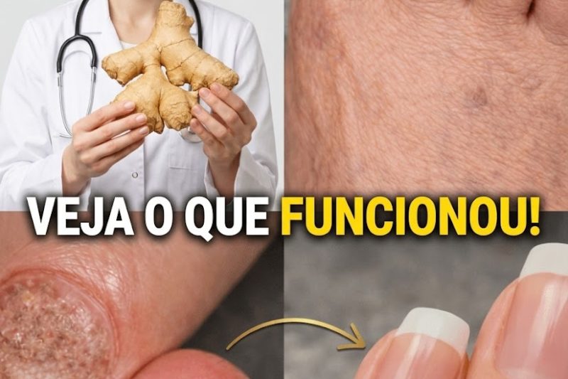O Ingrediente Surpreendente do Dia a Dia que Pode Ajudar a Melhorar a Saúde das Unhas dos Pés com o Tempo