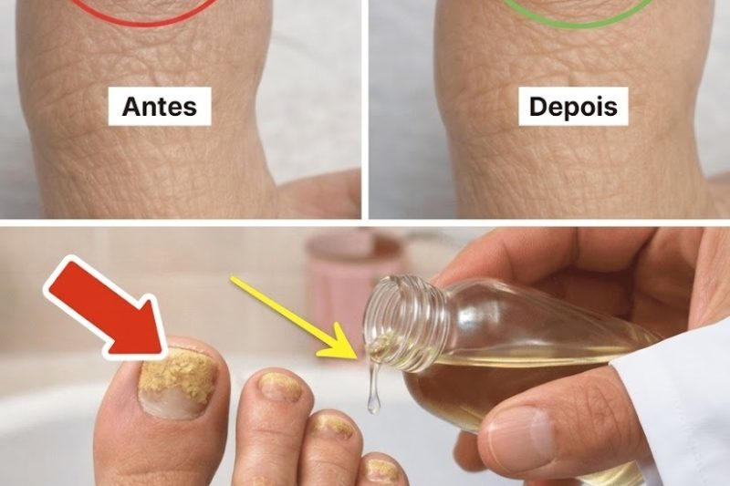 O Ritual Noturno Simples que Está Ajudando Milhares a Recuperar Unhas Saudáveis