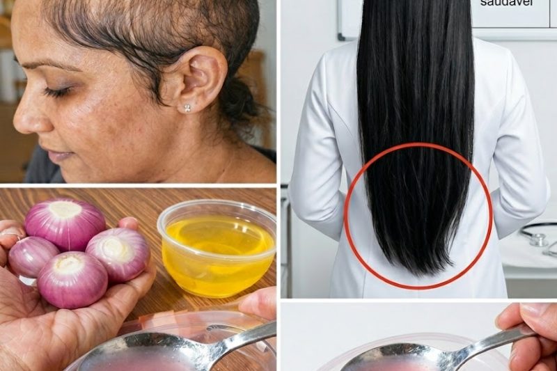 O Segredo para o Crescimento do Cabelo Escondido na Sua Cozinha: Como Fazer Óleo de Cebola que Pode Transformar Seus Fios