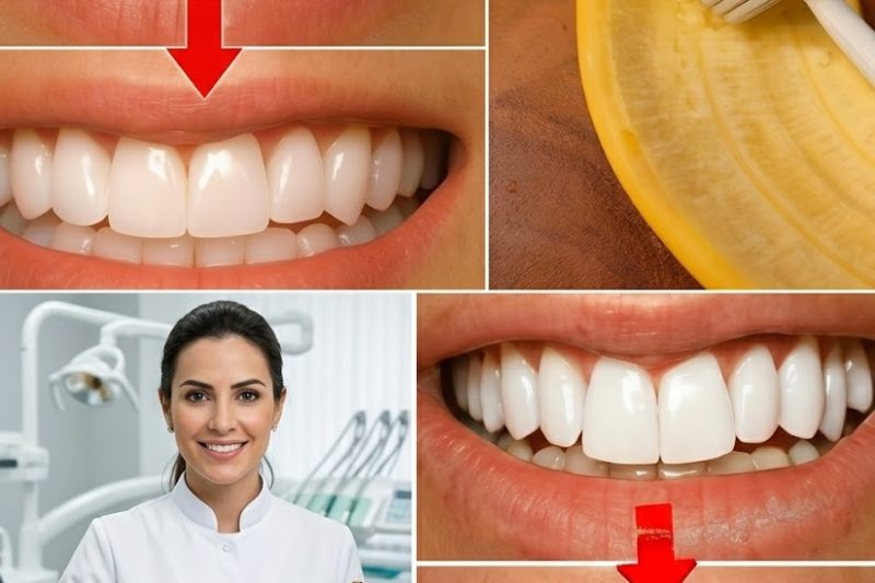 O Segredo de Um Milhão de Dólares Escondido no Seu Lixo: Cascas de Banana Para um Sorriso de Hollywood